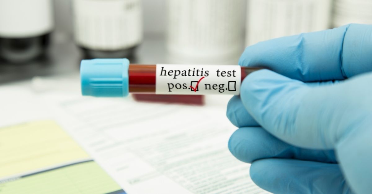 Hepatitis